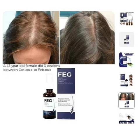 Hair Growth Spray